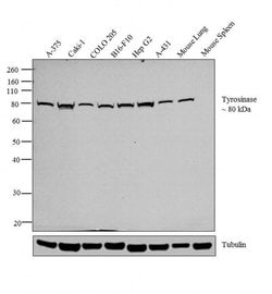 Invitrogen Tyrosinase Monoclonal Antibody (T311) 500 &mu;L; Unconjugated:Antibodies,
