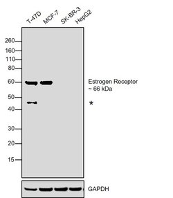 Invitrogen Estrogen Receptor alpha Monoclonal Antibody (SP1) 500 &mu;L;