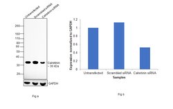 Invitrogen Calretinin Monoclonal Antibody (SP13) 500 &mu;L; Unconjugated:Antibodies,