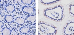 Invitrogen™ Apolipoprotein B Monoclonal Antibody (F2C3)