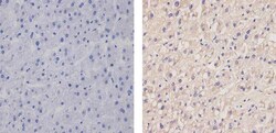 Invitrogen Apolipoprotein B Monoclonal Antibody (F2C4) 100 &mu;g | Buy Online | Invitrogen&trade; | Fisher Scientific