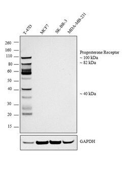 Invitrogen Progesterone Receptor Monoclonal Antibody (R.809.9) 100 &mu;L | Buy Online | Invitrogen&trade; | Fisher Scientific