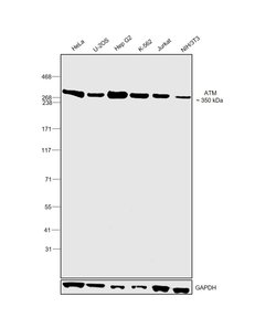 Invitrogen ATM Monoclonal Antibody (C.74.4) 100 &mu;L; Unconjugated:Antibodies,