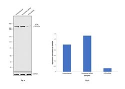 Invitrogen ATM Monoclonal Antibody (C.74.4) 100 &mu;L; Unconjugated:Antibodies,