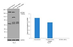 Invitrogen SETDB1 Monoclonal Antibody (K.137.7) 100 &mu;L; Unconjugated:Antibodies,