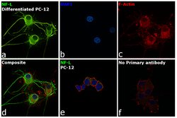 Invitrogen NEFL Monoclonal Antibody (T.400.5) 100 &mu;L | Buy Online | Invitrogen&trade; | Fisher Scientific