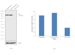 Invitrogen IRE1 alpha Monoclonal Antibody (J.607.10) 100 &mu;L; Unconjugated:Antibodies,