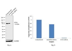 Invitrogen GYS1 Monoclonal Antibody (J.18.5) 100 &mu;L; Unconjugated:Antibodies,