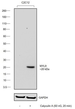 Invitrogen Phospho-MYL9 (Ser19) Monoclonal Antibody (R.179.1) 100 &mu;L;