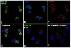 Invitrogen Zap-70 Monoclonal Antibody (J.947.4) 100 &mu;L; Unconjugated:Antibodies,