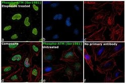 Invitrogen Phospho-ATM (Ser1981) Monoclonal Antibody (C.70.6) 100 &mu;L;