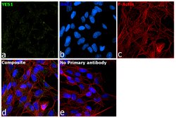 Invitrogen YES1 Monoclonal Antibody (2F3E6) 100 &mu;L; Unconjugated:Antibodies,
