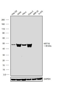 Invitrogen Cytokeratin 18 Monoclonal Antibody (4D11E4) 100 &mu;L; Unconjugated:Antibodies,