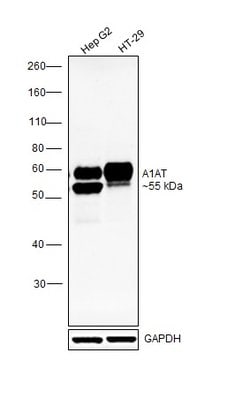 Invitrogen alpha-1 Antitrypsin Monoclonal Antibody (2B12) 100 &mu;L; Unconjugated:Antibodies,