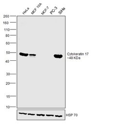 Invitrogen Cytokeratin 17 Monoclonal Antibody (3B12) 100 &mu;L; Unconjugated:Antibodies,