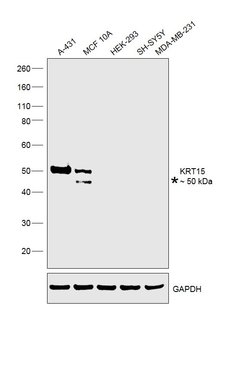 Invitrogen Cytokeratin 15 Monoclonal Antibody (6E7) 100 &mu;L; Unconjugated:Antibodies,