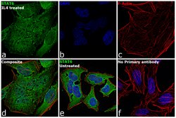 Invitrogen STAT6 Monoclonal Antibody (7D3) 100 &mu;L | Buy Online | Invitrogen&trade; | Fisher Scientific