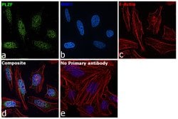 Invitrogen PLZF Monoclonal Antibody (5B3) 100 &mu;L; Unconjugated:Antibodies,