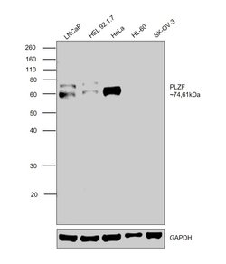 Invitrogen PLZF Monoclonal Antibody (5B3) 100 &mu;L; Unconjugated:Antibodies,