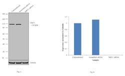 Invitrogen SIRT1 Monoclonal Antibody (1F3) 100 &mu;L; Unconjugated:Antibodies,