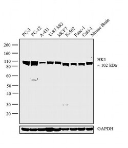 HK1 Monoclonal Antibody (3A10):Antibodies, Monoclonal