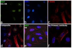 Invitrogen Ki-67 Monoclonal Antibody (8D5) 100 &mu;L; Unconjugated:Antibodies,