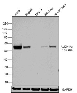 Invitrogen ALDH1A1 Monoclonal Antibody (5A11) 100 &mu;L; Unconjugated:Antibodies,