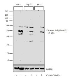 Invitrogen Carbonic Anhydrase IX Monoclonal Antibody (2D3) 100 &mu;L; Unconjugated:Antibodies,