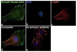 Invitrogen Alpha-Smooth Muscle Actin Monoclonal Antibody (4F4) 100 &mu;L;