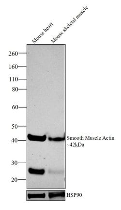 Invitrogen Alpha-Smooth Muscle Actin Monoclonal Antibody (4F4) 100 &mu;L;
