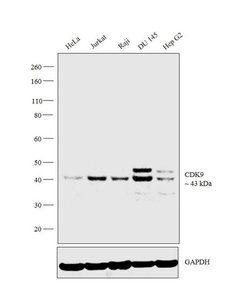 Invitrogen CDK9 Monoclonal Antibody (1B5A7) 100 &mu;L; Unconjugated:Antibodies,