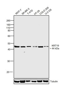 Invitrogen Cytokeratin 19 Monoclonal Antibody (1H6) 100 &mu;L | Buy Online | Invitrogen&trade; | Fisher Scientific