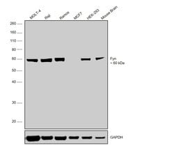 Invitrogen Fyn Monoclonal Antibody (2H8) 100 &mu;L | Buy Online | Invitrogen&trade; | Fisher Scientific