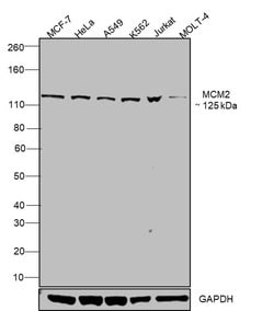 Invitrogen MCM2 Monoclonal Antibody (1E7) 100 &mu;L; Unconjugated:Antibodies,