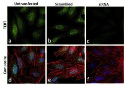 TERT Monoclonal Antibody (2D8):Antibodies, Monoclonal