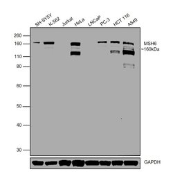 Invitrogen MSH6 Monoclonal Antibody (SP93) 500 &mu;L; Unconjugated:Antibodies,