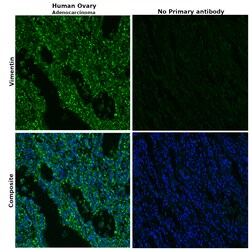Invitrogen Vimentin Monoclonal Antibody (SP20) 500 &mu;L; Unconjugated:Antibodies,