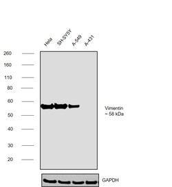 Invitrogen Vimentin Monoclonal Antibody (SP20) 500 &mu;L; Unconjugated:Antibodies,