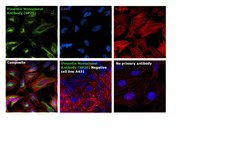 Invitrogen Vimentin Monoclonal Antibody (SP20) 500 &mu;L; Unconjugated:Antibodies,