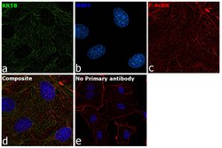 Invitrogen Cytokeratin 8 Monoclonal Antibody (SP102) 500 &mu;L; Unconjugated:Antibodies,