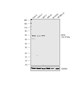 Invitrogen Cytokeratin 8 Monoclonal Antibody (SP102) 500 &mu;L; Unconjugated:Antibodies,