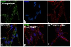 CD10 Monoclonal Antibody (SN5c):Antibodies, Monoclonal