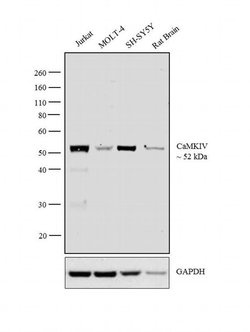 Invitrogen CaMKIV Monoclonal Antibody (8C5B8) 100 &mu;g; Unconjugated:Antibodies,