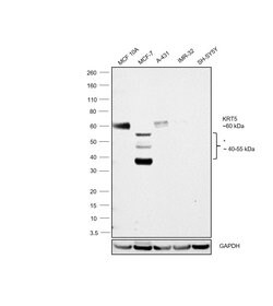 Invitrogen Cytokeratin 5 Monoclonal Antibody (2C2) 100 &mu;g; Unconjugated:Antibodies,