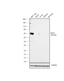 Invitrogen Cytokeratin 5 Monoclonal Antibody (10C11E6) 100 &mu;g; Unconjugated:Antibodies,
