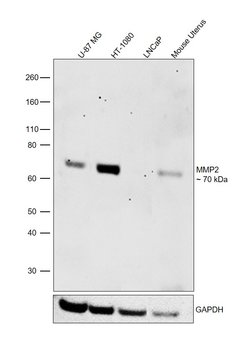 Invitrogen MMP2 Monoclonal Antibody (4D1E2) 100 &mu;g; Unconjugated:Antibodies,