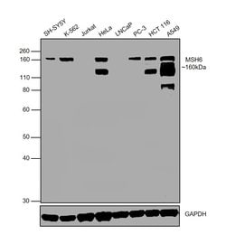 Invitrogen MSH6 Monoclonal Antibody (3E1) 100 &mu;L; Unconjugated:Antibodies,