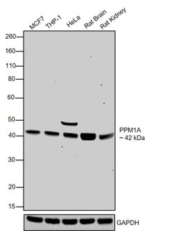 Invitrogen PPM1A Monoclonal Antibody (7F12) 100 &mu;g; Unconjugated:Antibodies,