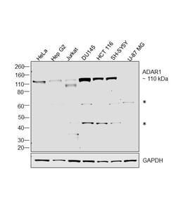 Invitrogen ADAR Monoclonal Antibody (GT1066) 100 &mu;L; Unconjugated:Antibodies,