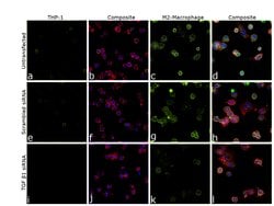 Invitrogen TGF beta-1 Monoclonal Antibody (TB21) 100 &mu;L; Unconjugated:Antibodies,